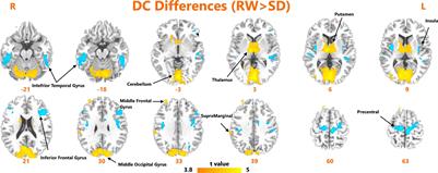 Classifying Vulnerability to Sleep Deprivation Using Resting-State Functional MRI Graph Theory Metrics